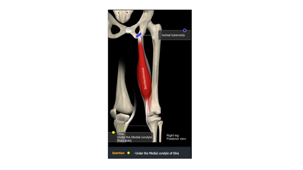 Treino_em_foco_isquiotibiais_posterior_da_coxa