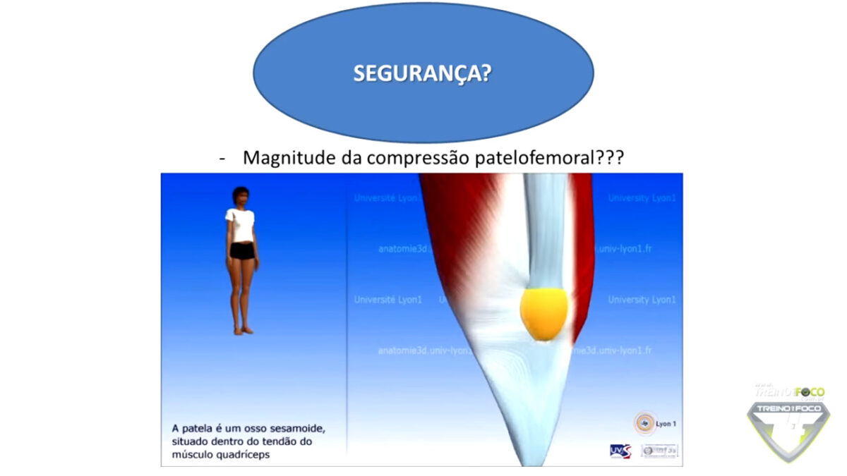 FLEXÃO_NORDICA_COMPRESSÃO_PATELOFEMORAL_TREINO_EM_FOCO