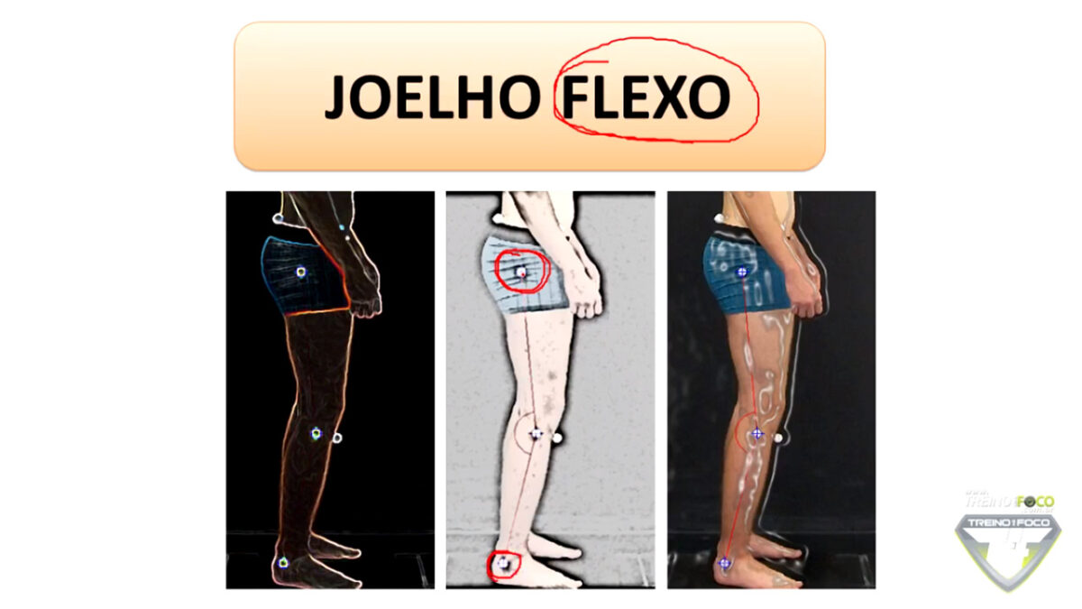 desvio_postural_joelho_flexo_treino_em_foco_joelho_flexo_biofotogrametria