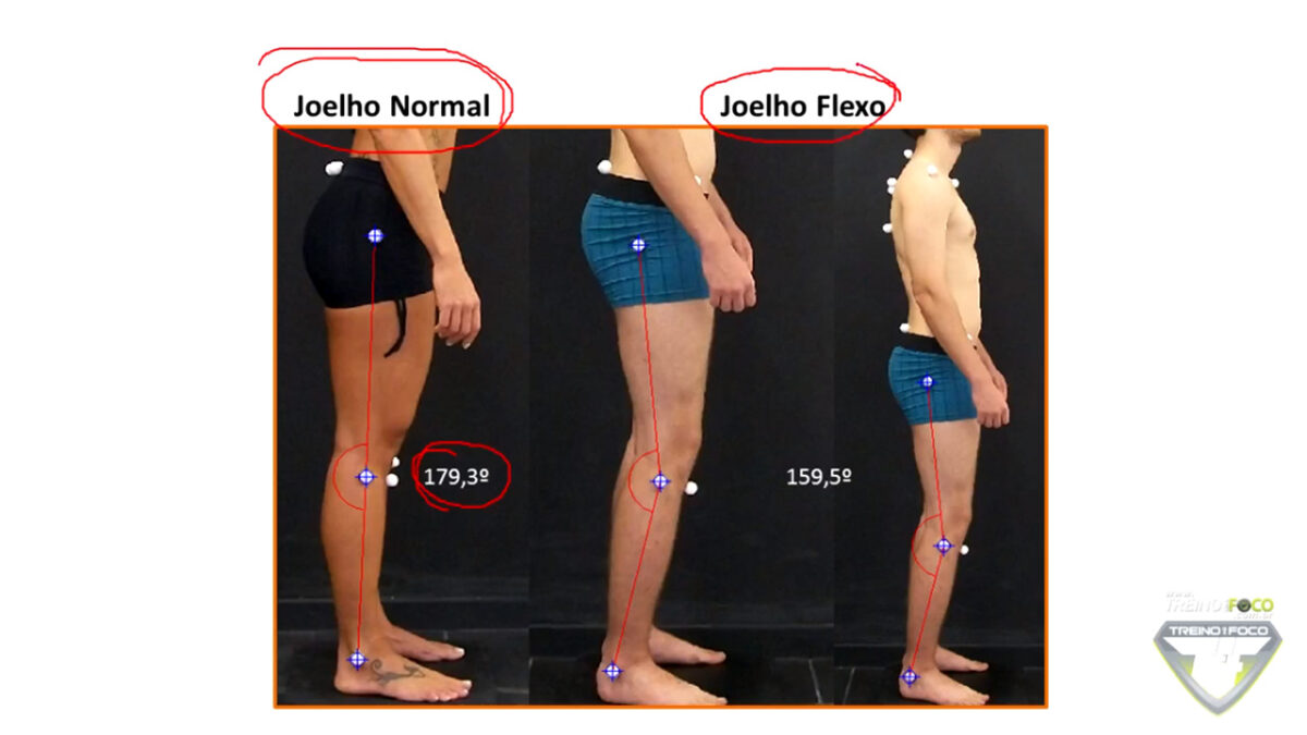 joelho_flexo_treino_em_foco_biofotogrametria_avaliação_postural