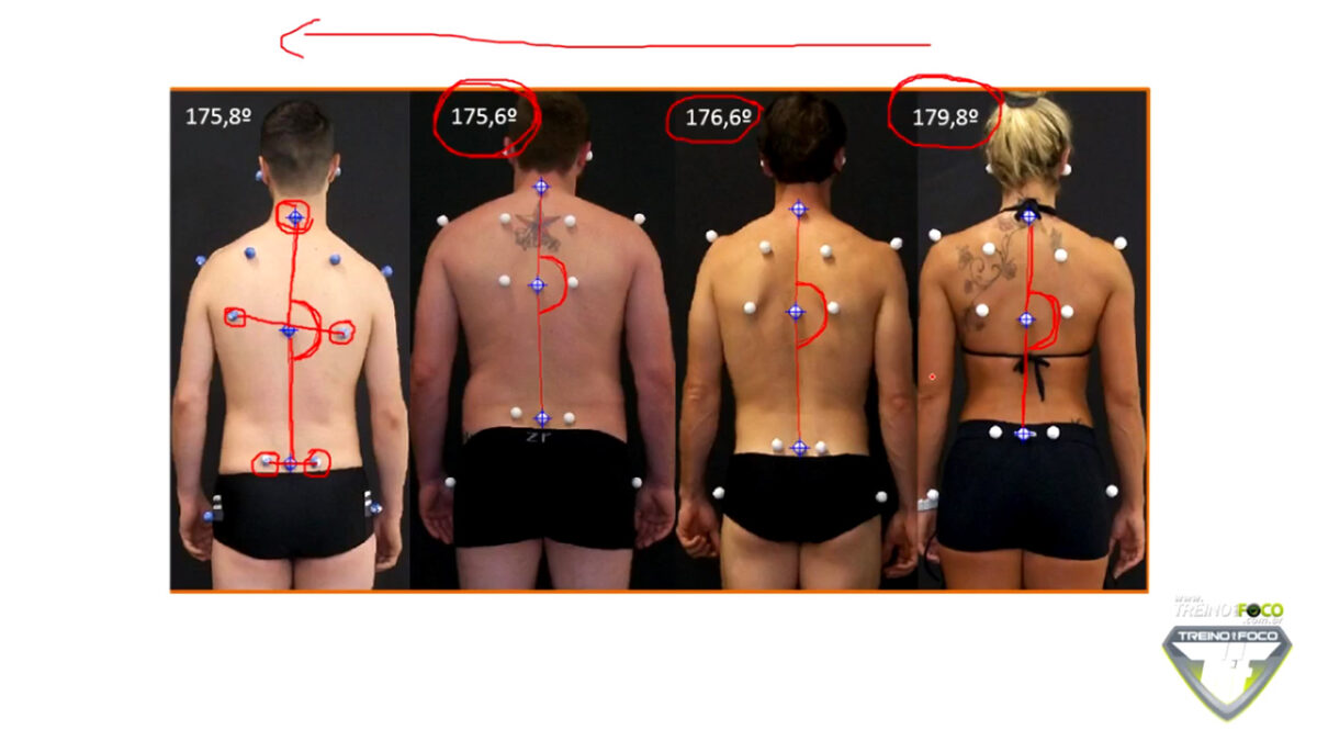 avaliação_postural_treino_em_foco_biofotogrametria_escoliose