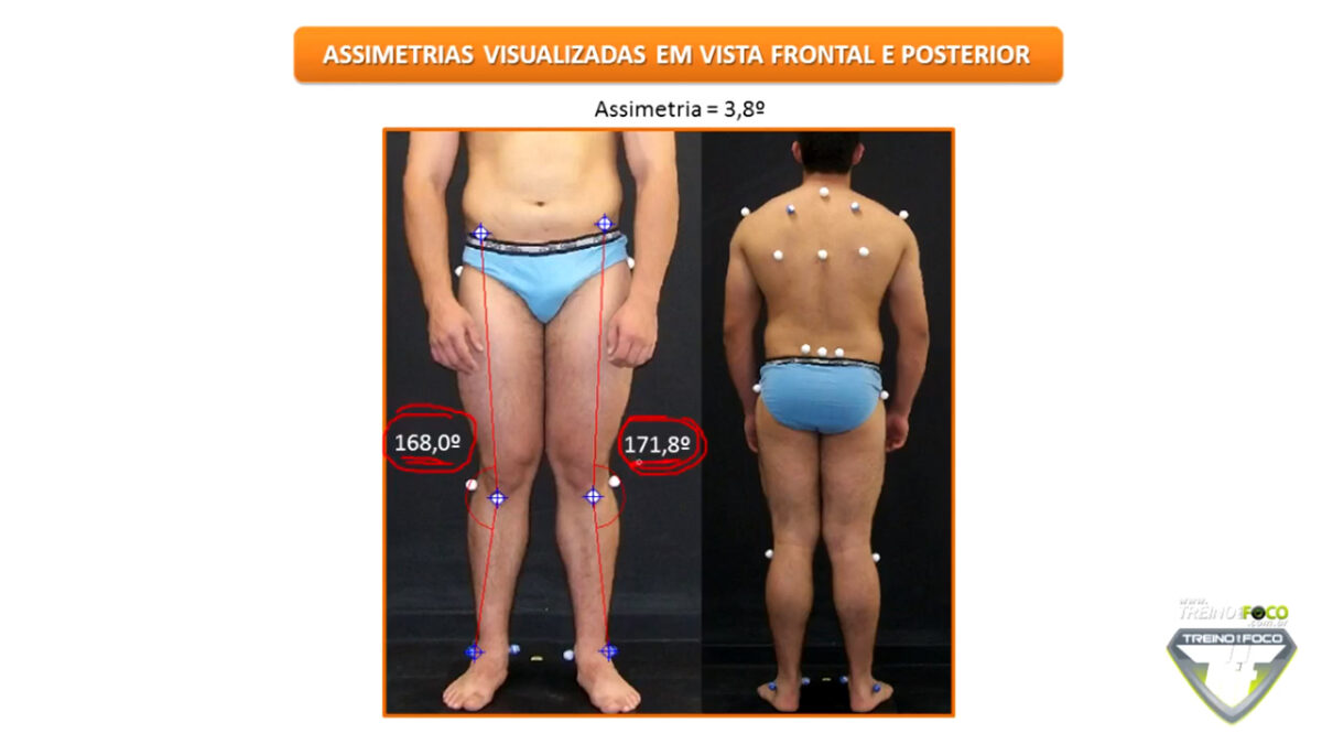 biofotogrametria_desvios_posturais_treino_em_foco_assimetria_de_joelho