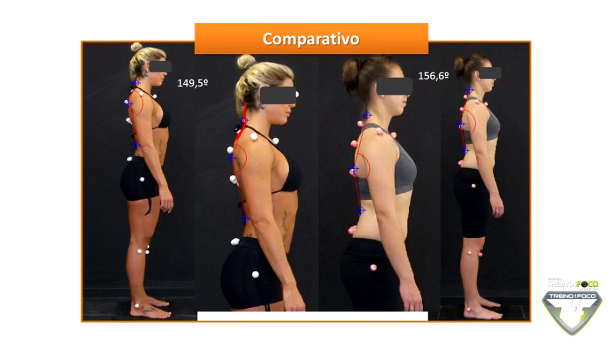 treino_em_foco_biofotogrametria_desvios_posturais_hipocifose_torácica