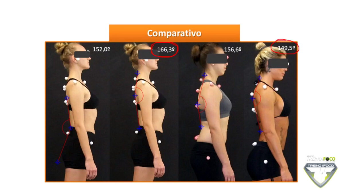 treino_em_foco_biofotogrametria_hipocifose_torácica_desvios_posturais_