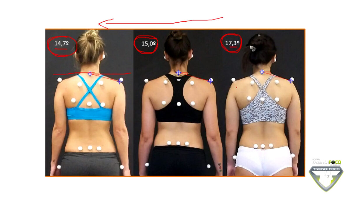 biofotogrametria_desvios_posturais_ombros_elevados_treino_em_foco