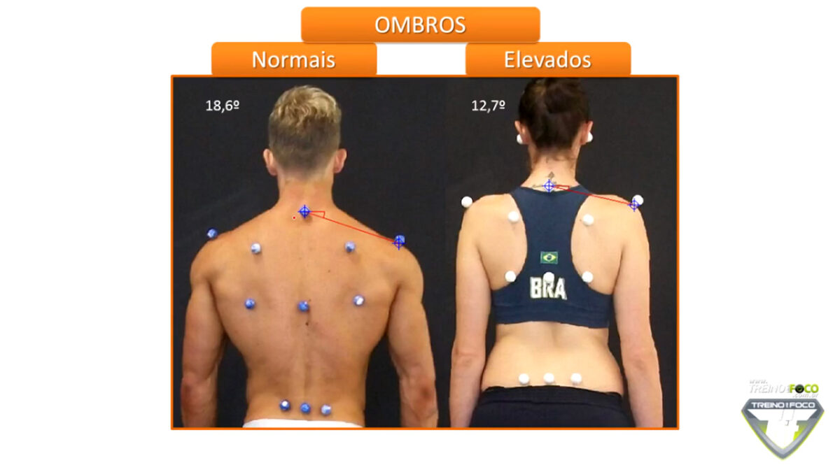 ombros_elevados_treino_em_foco_desvios_posturais_biofotogrametria