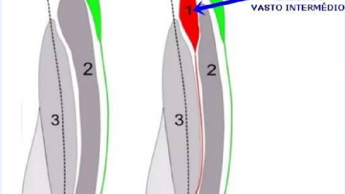 treino_em_foco_tensor_do_vasto_intermédio_alogamento_flexionamento_quadríceps