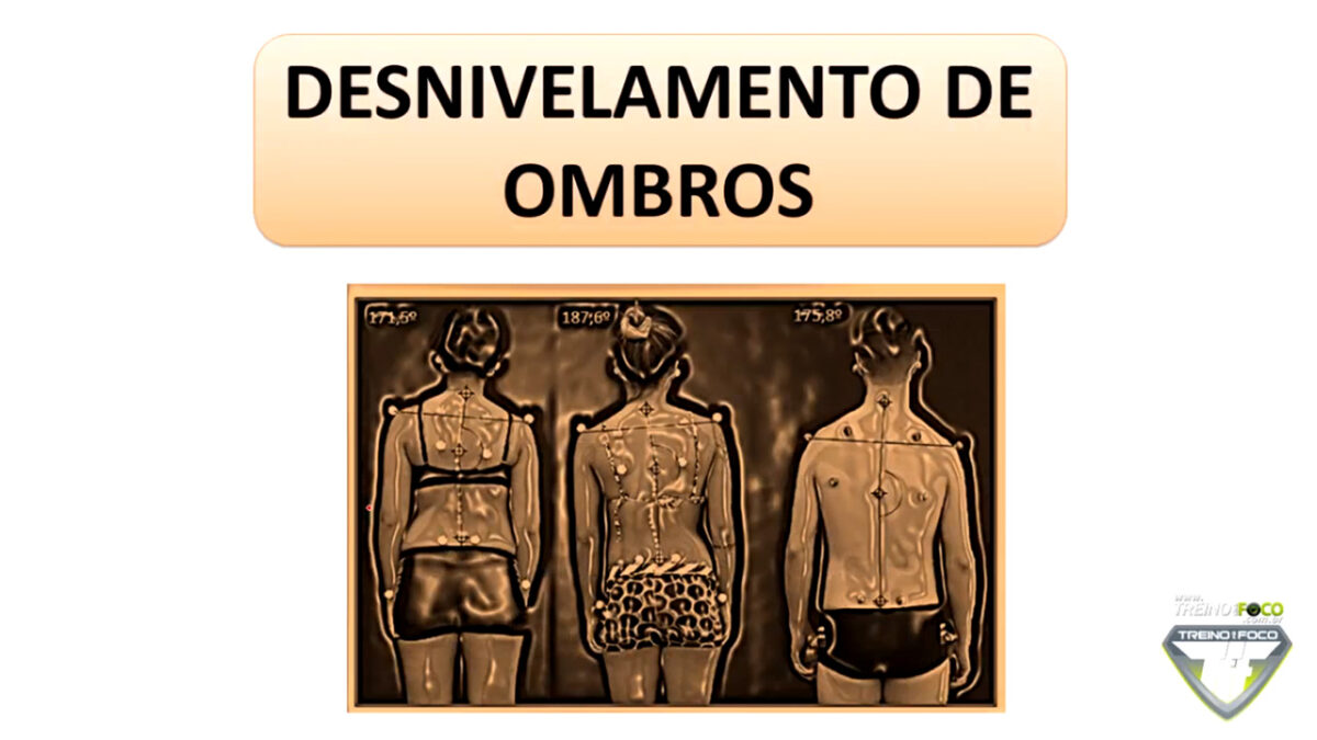 treino_em_foco_desnivelamento_dos_ombros_biofotogrametria_desvios_posturais