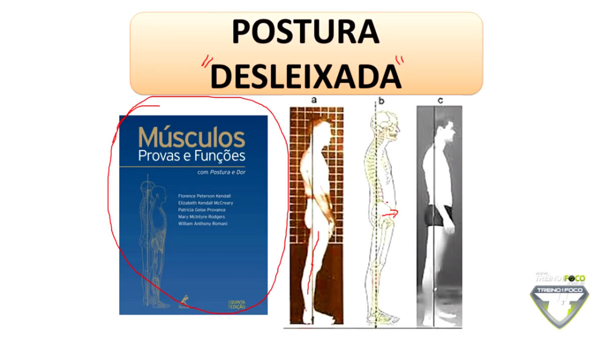 treino_em_foco_postura_desleixada_alteraçãoes_posturais_desvios_posturais