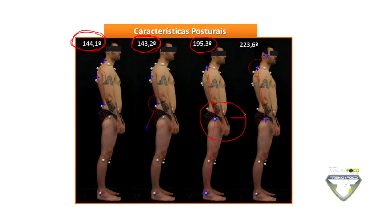 treino_em_foco_postura_desleixada_alteraçãoes_posturais_desvios_posturais