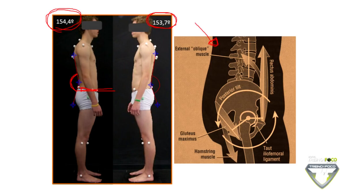 treino_em_foco_alongamento_exercicios_musculos_abdominais_reto_abdominal