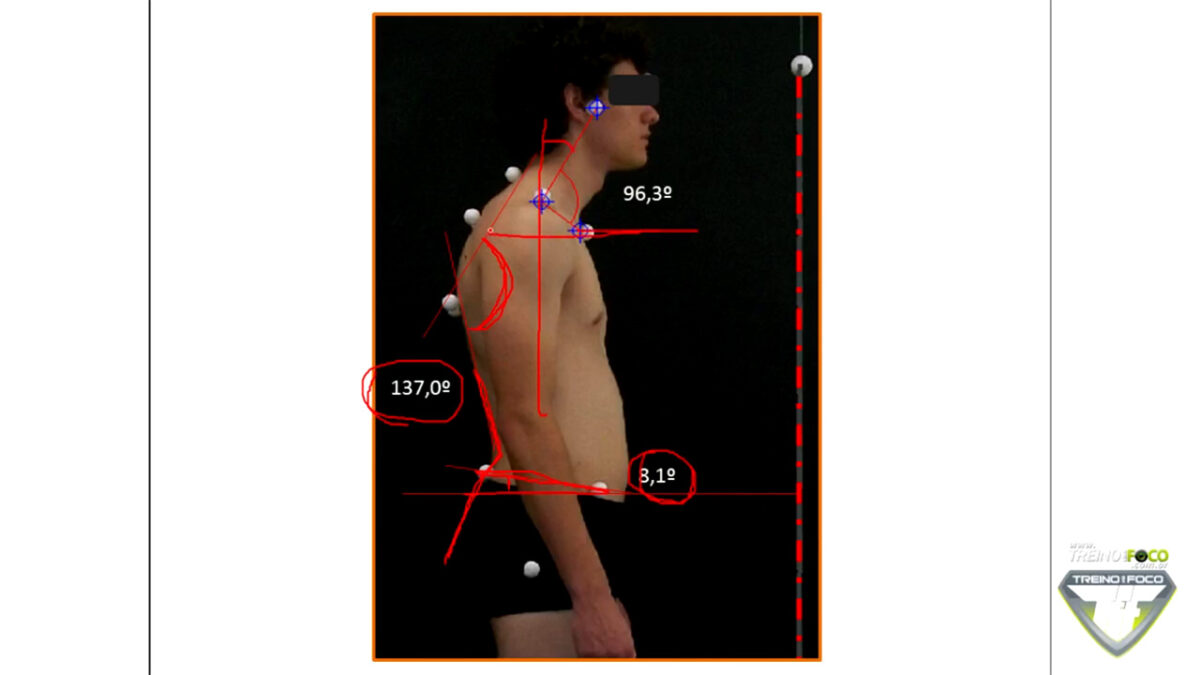 desvios_posturais_treino_em_foco_biofotogrametria