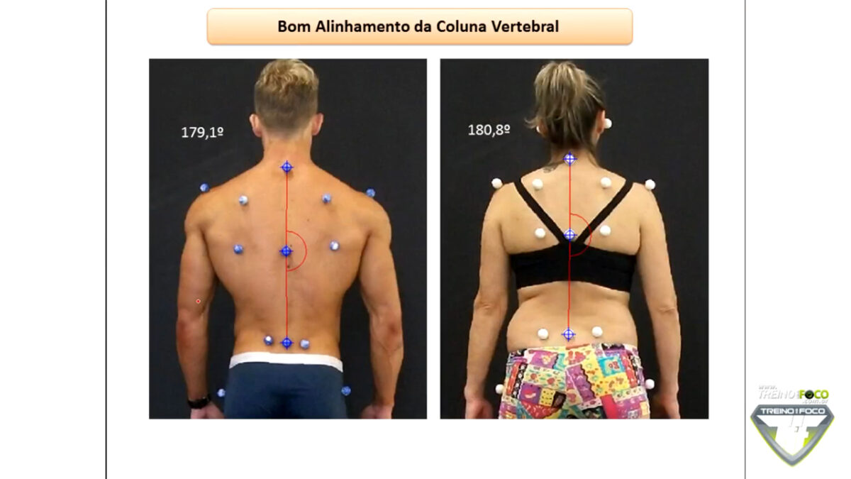 treino_em_foco_bom_alinhamento_postural_biofotogrametria