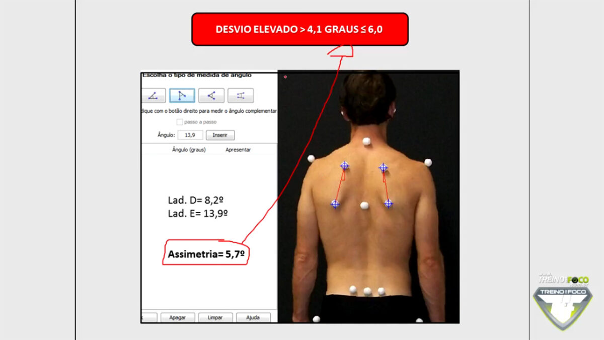 assimetria_escapulas_treino_em_foco