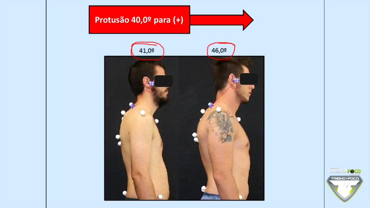 protrusao_da_cabeca_treino_em_foco_referencias_biofotogrametricas
