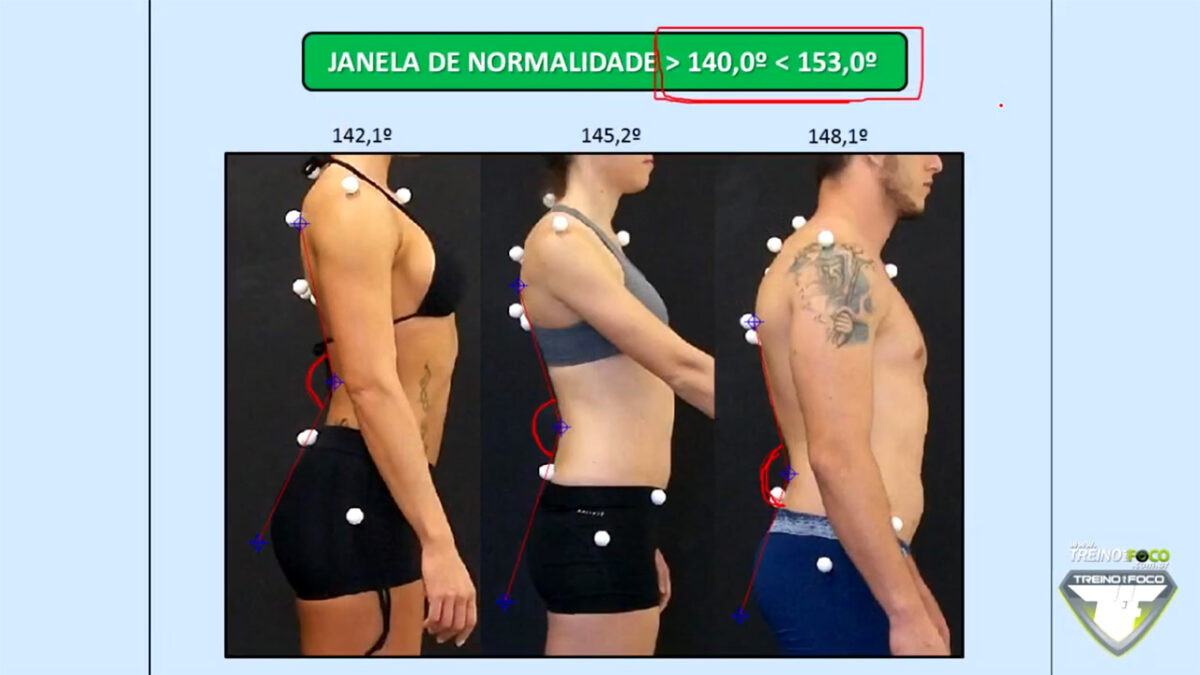 referencias_biofotogrametricas_clinicas_treino_em_foco_lordose_lombar