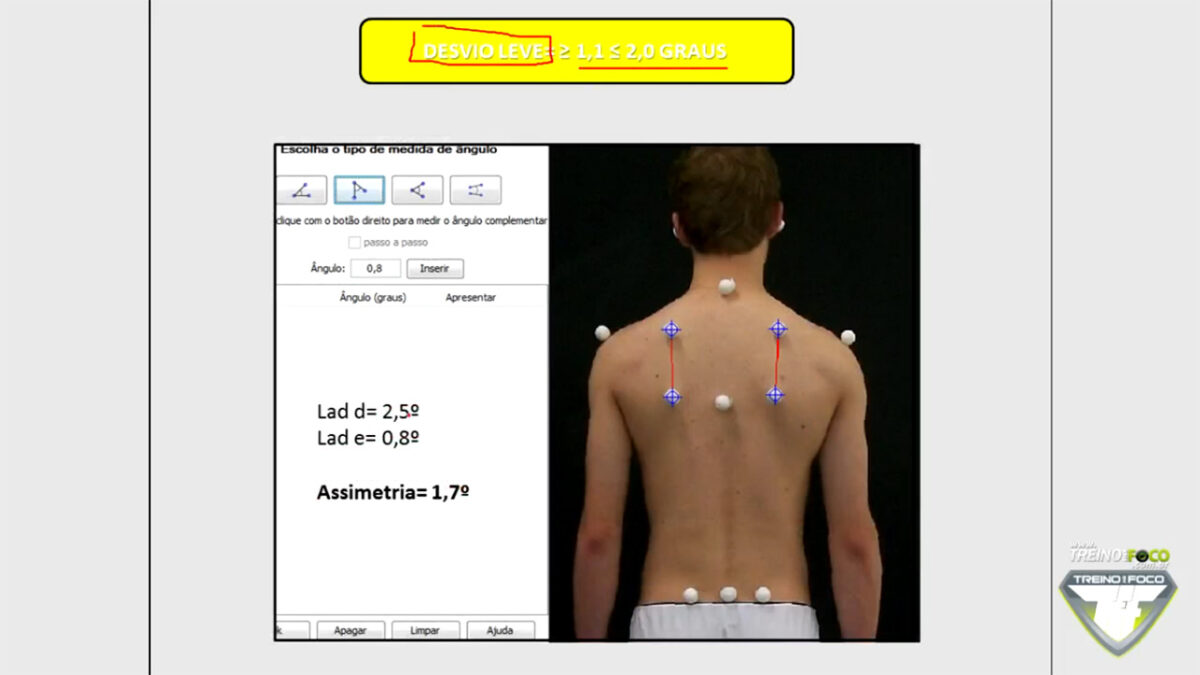 treino_em_foco_assimetria_escapulas_referencias