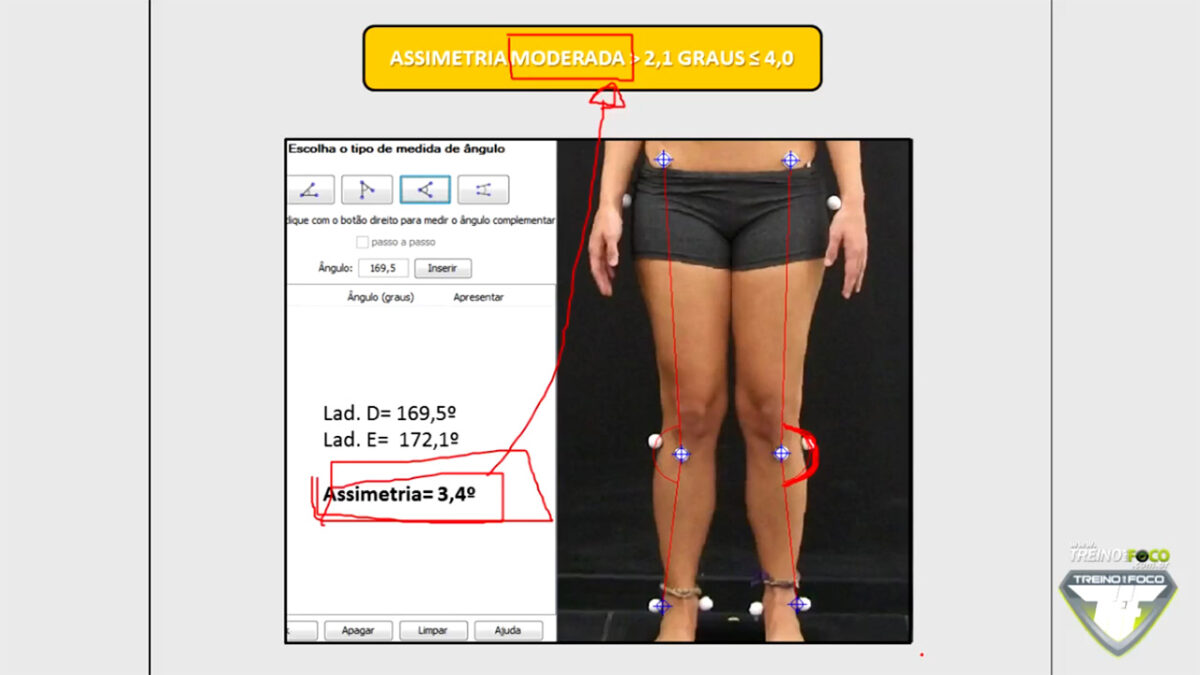 treino_em_foco_assimetria_joelhos_referencias_clinicas