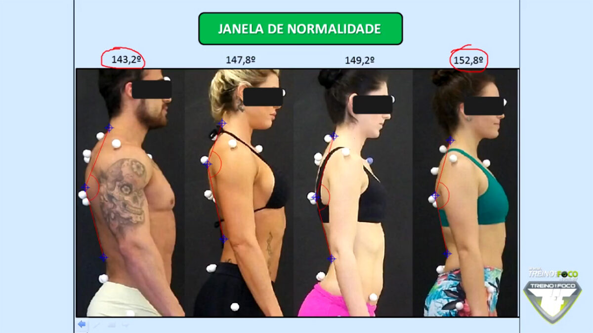 treino_em_foco_biofotogrametria_cifose_toracica