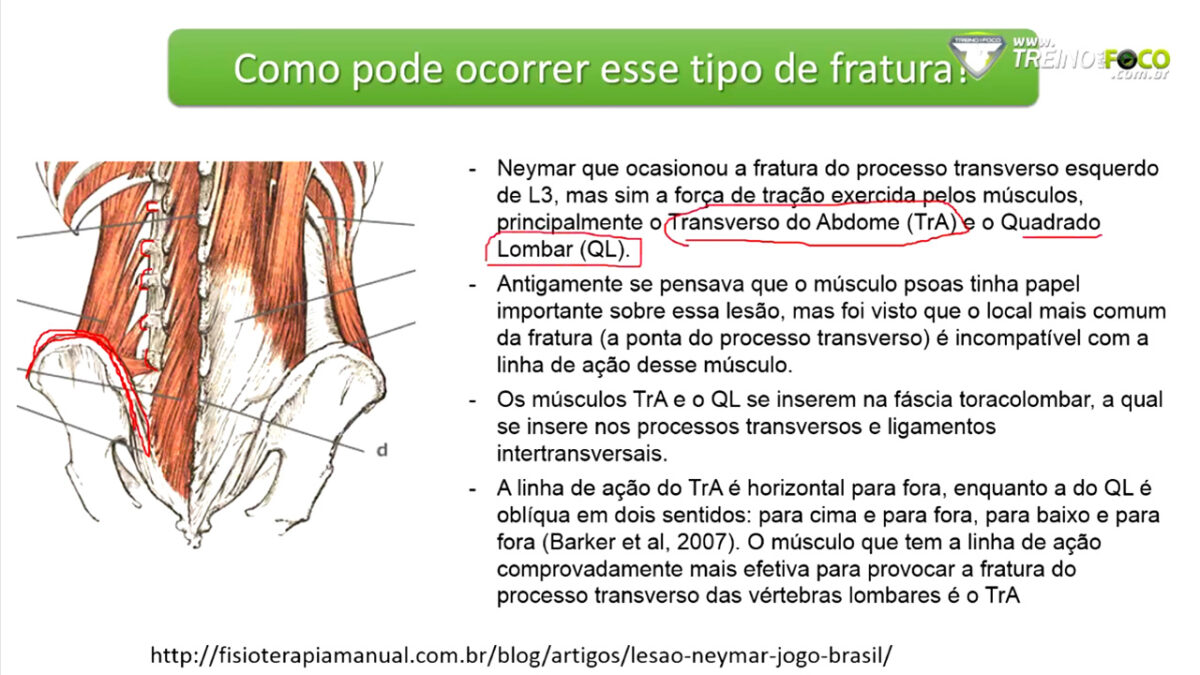 treino_em_foco_coluna_vertebral_musculo_quadrado_lombar