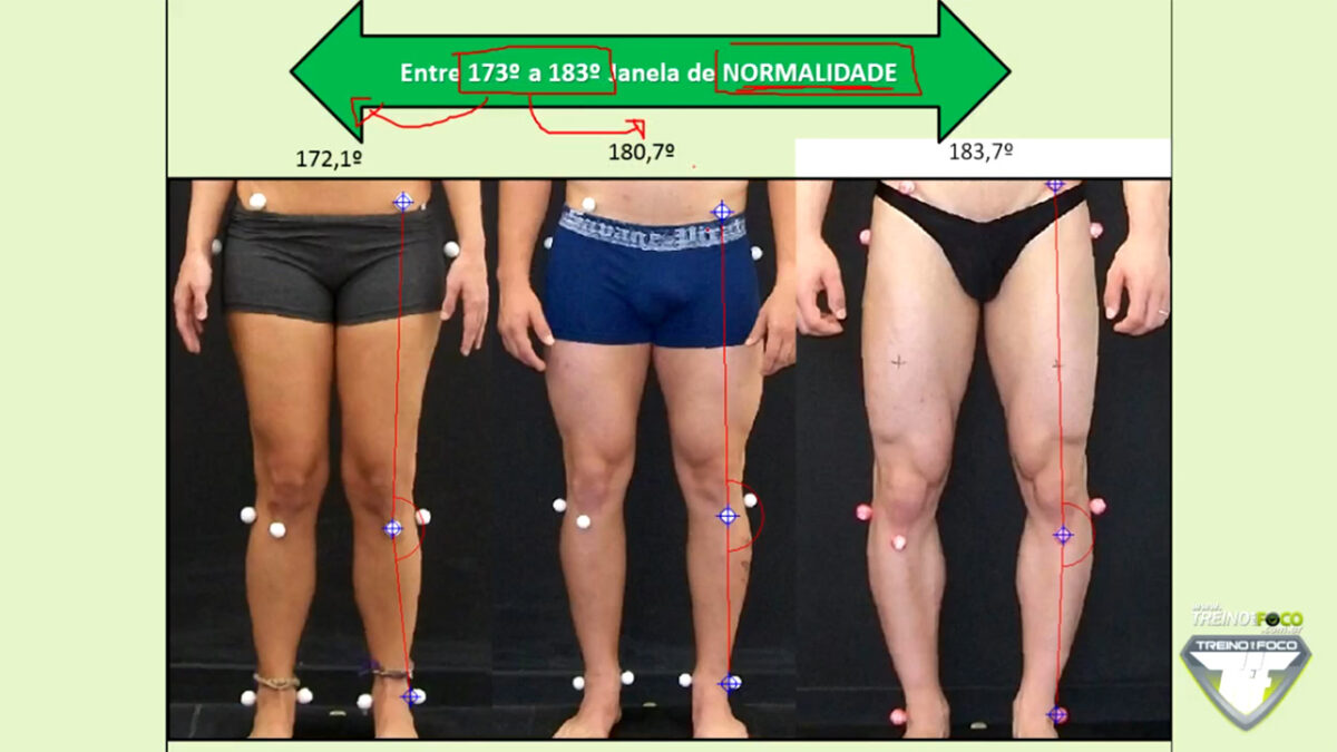 treino_em_foco_referencias_biofotogrametricas_joelho_normal