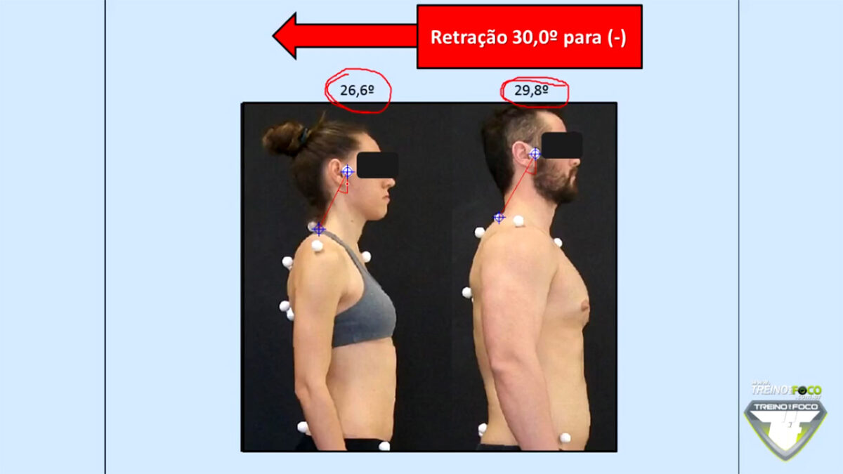 treino_em_foco_retracao_da_cabeca