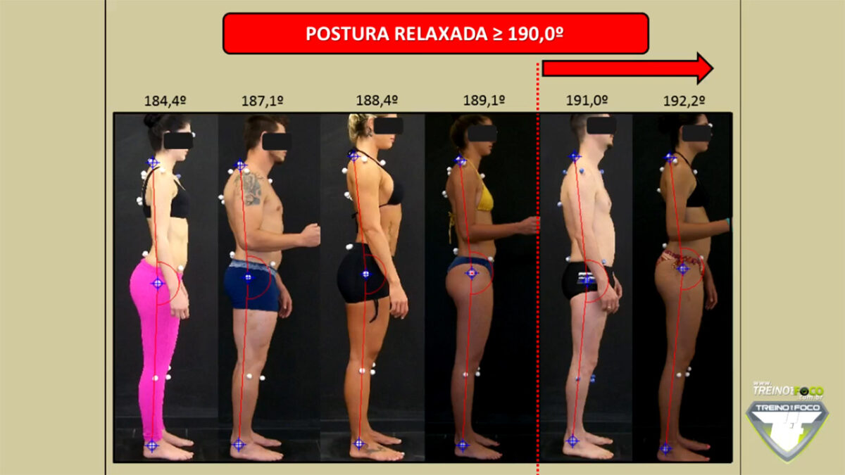 postura_desleixada_relaxada_treino_em_foco_referencias_biofotogrametricas