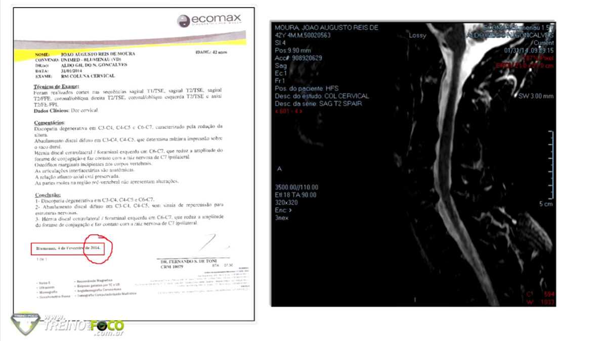 treino_em_foco_patologia_coluna_vertebral_site