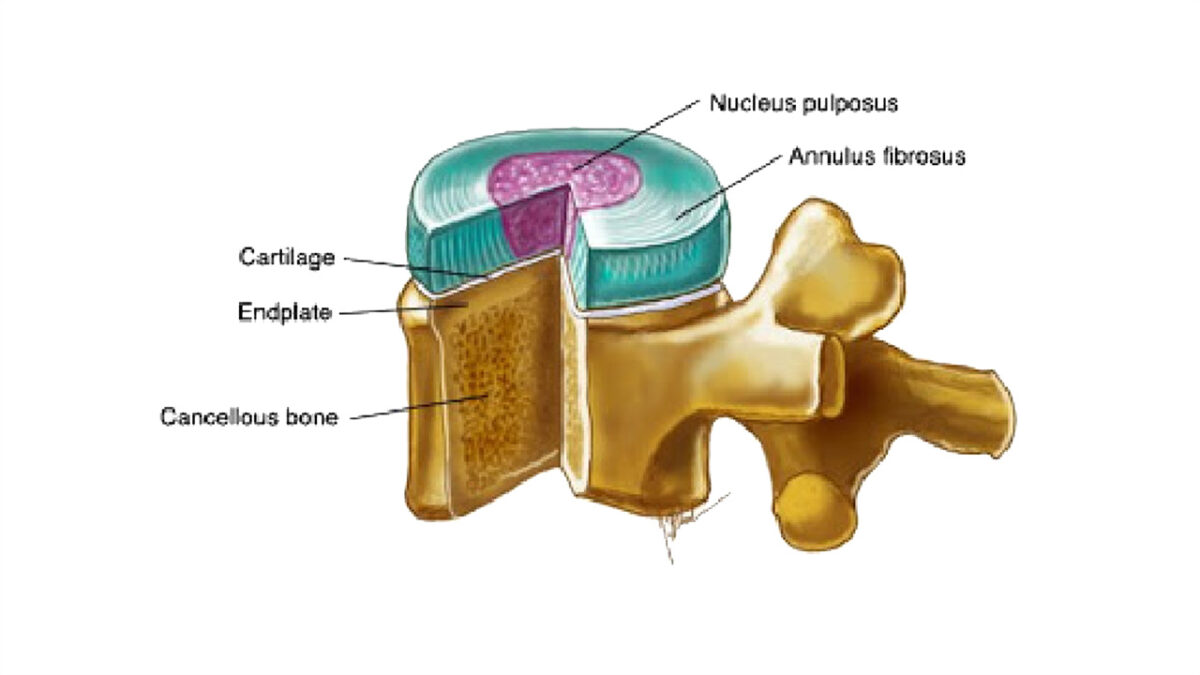 treino_em_foco_coluna_vetberal_disco_intervertebral