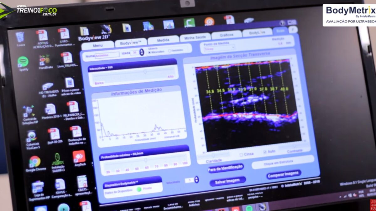 Treino_em_foco_ultrassom_espessura_densidade_muscular