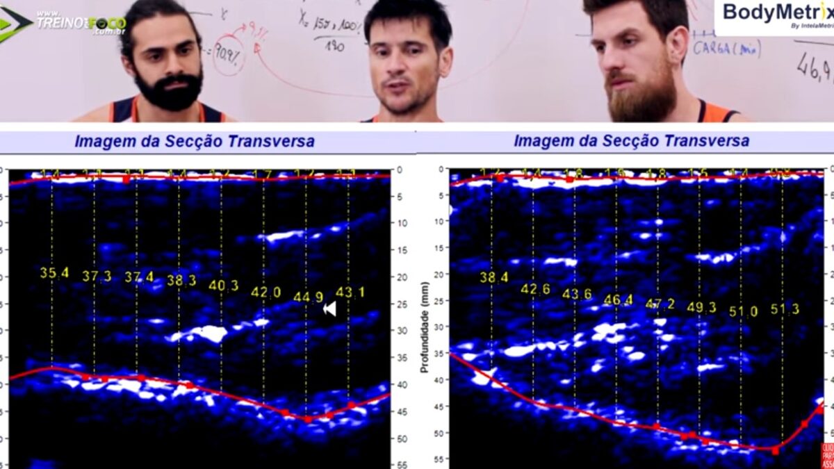 Treino_em_foco_ultrassom_avaliação_morfológica