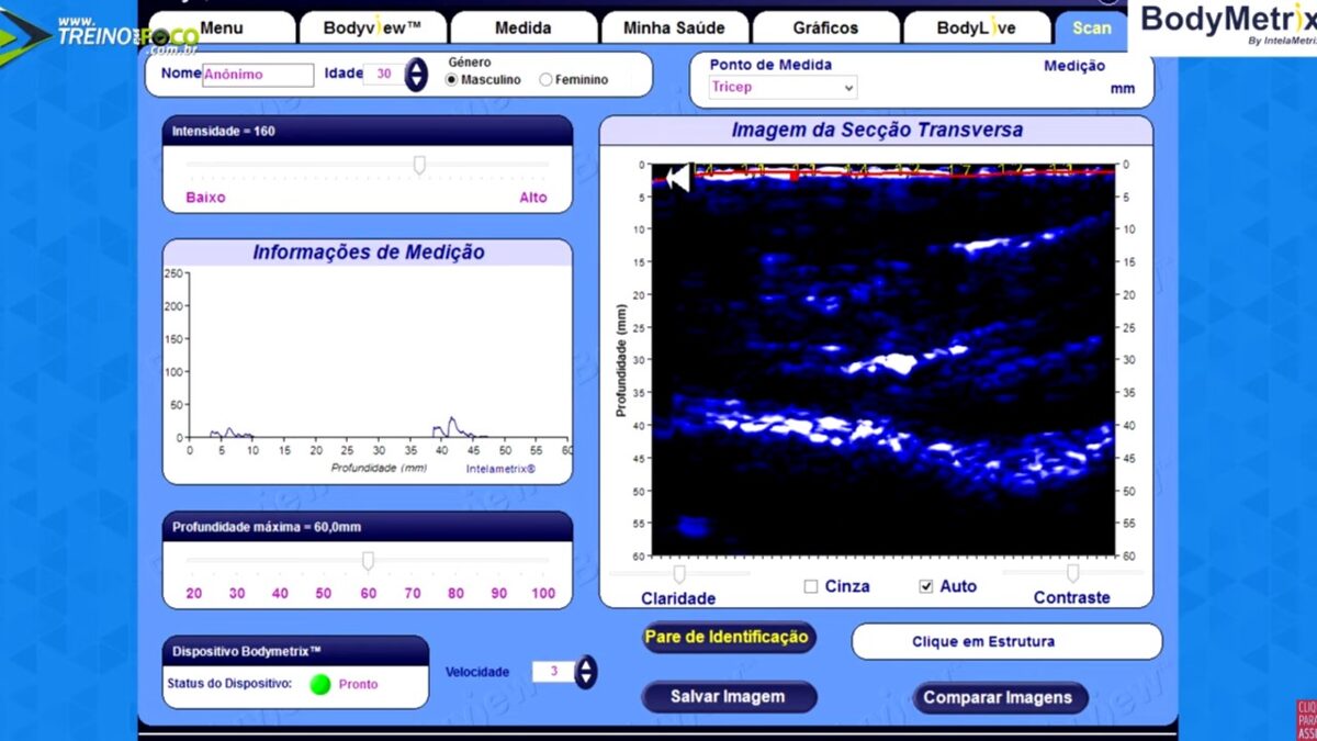 Treino_em_foco_ultrassom_avaliação_morfológica