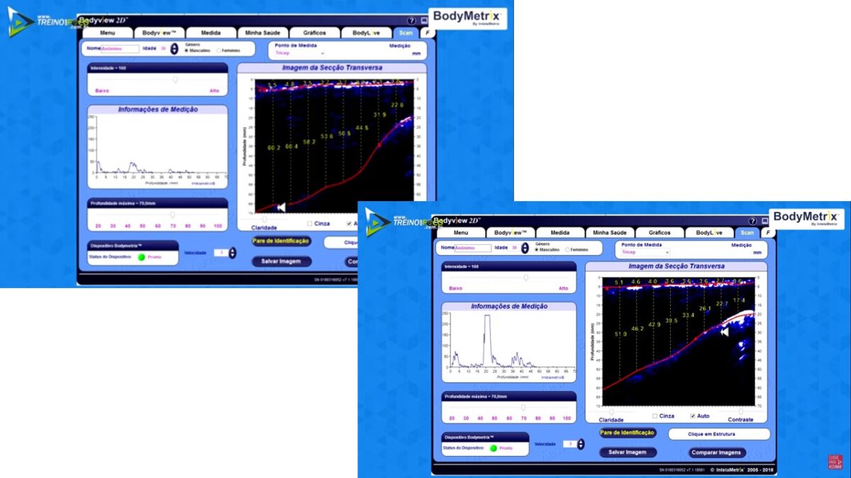 Treino_em_foco_ultrassom_antropometria