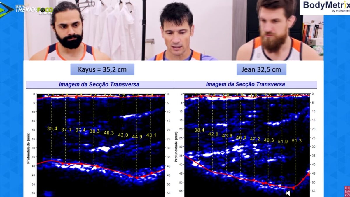 Treino_em_foco_ultrassom_espessura_muscular