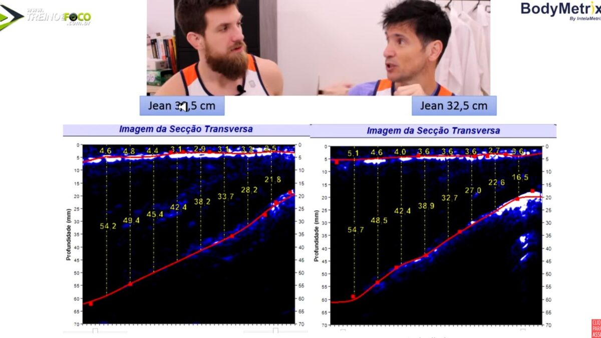 Treino_em_foco_ultrassom_assimetria_muscula