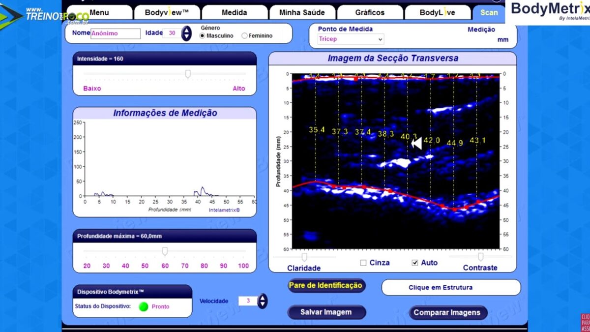 Treino_em_foco_ultrassom_avaliação_morfológica