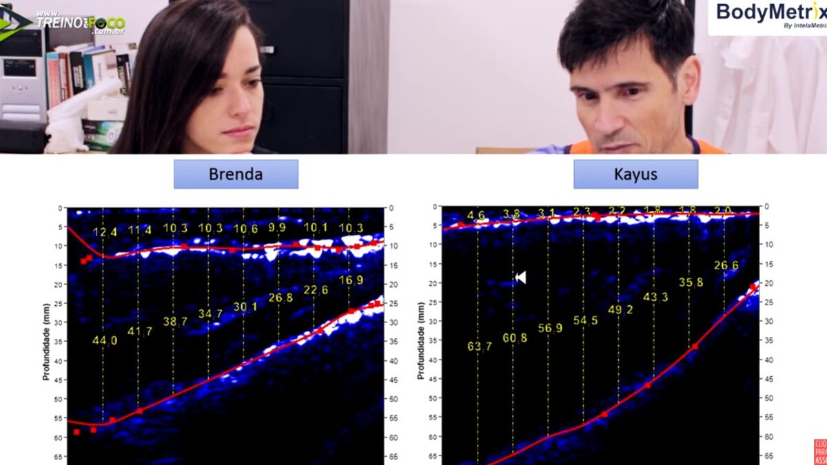 Treino_em_foco_ultrassom_densidade_muscular