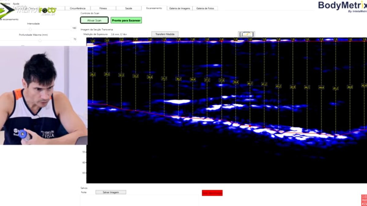 Treino_em_foco_avaliação_morfológica_ultrassom