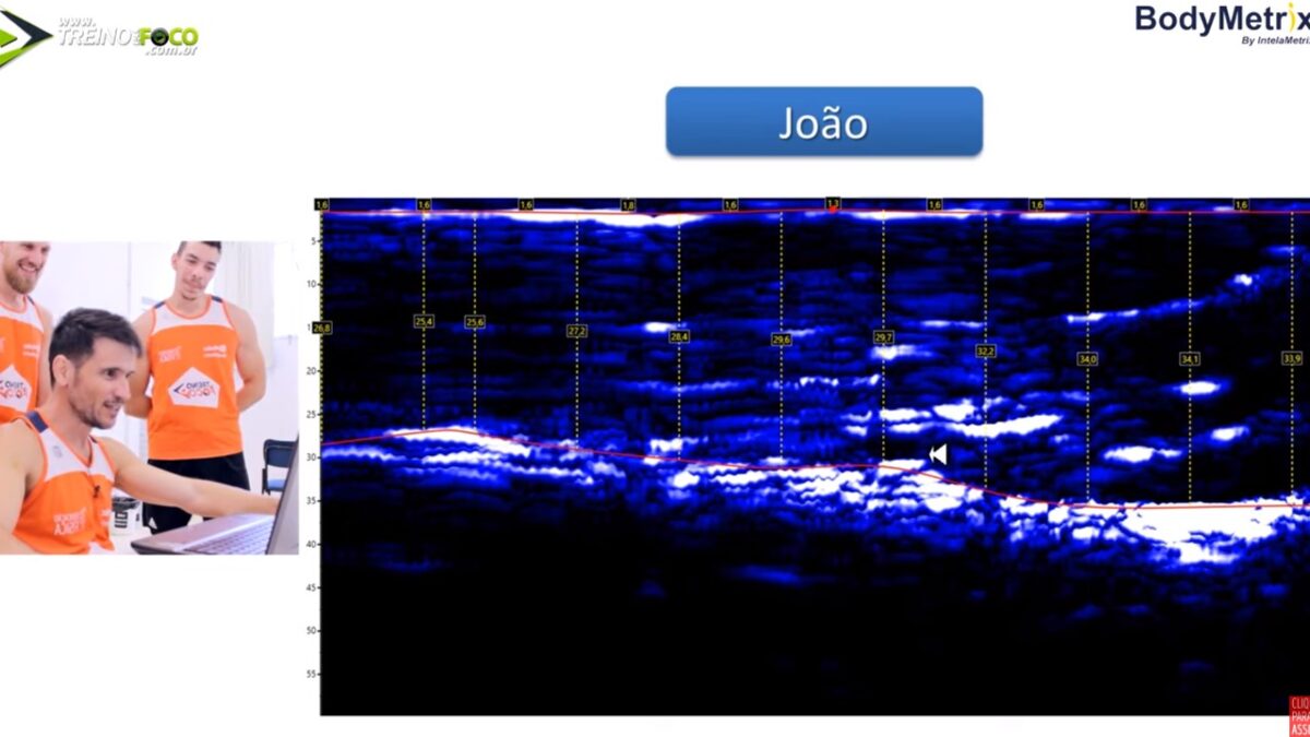Treino_em_foco_avaliação_morfológica_ultrassom