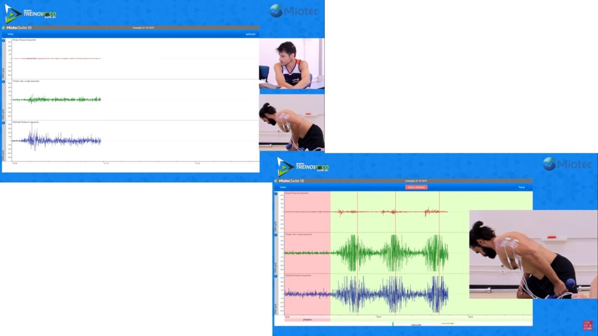 treino_em_foco_chute_de_triceps_eletromiografia_análise