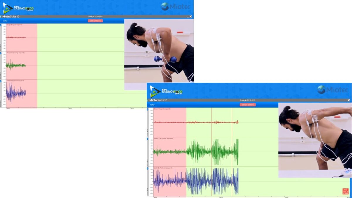 Treino_em_foco_chute_de_tríceps_ativação_do_bíceps