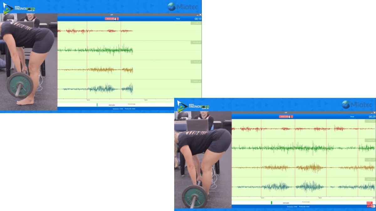 Treino_em_foco_stiff_variações_atividade_eletromiográfica