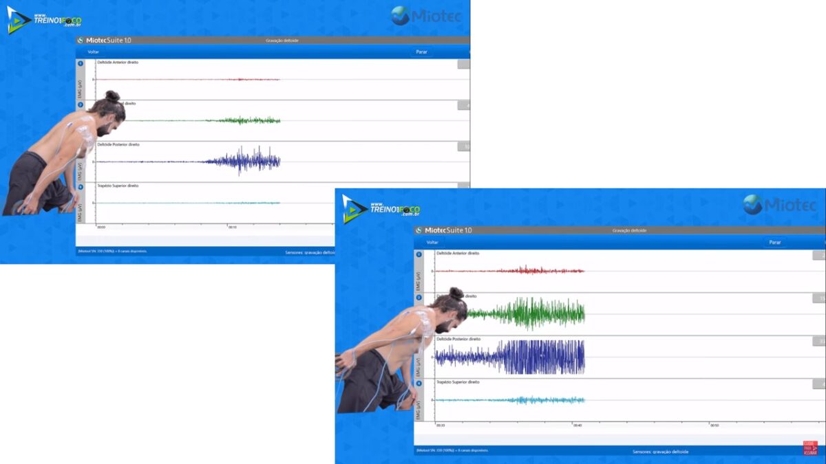 Treino_em_foco_eletromiografia_remada_deltoide_posterior