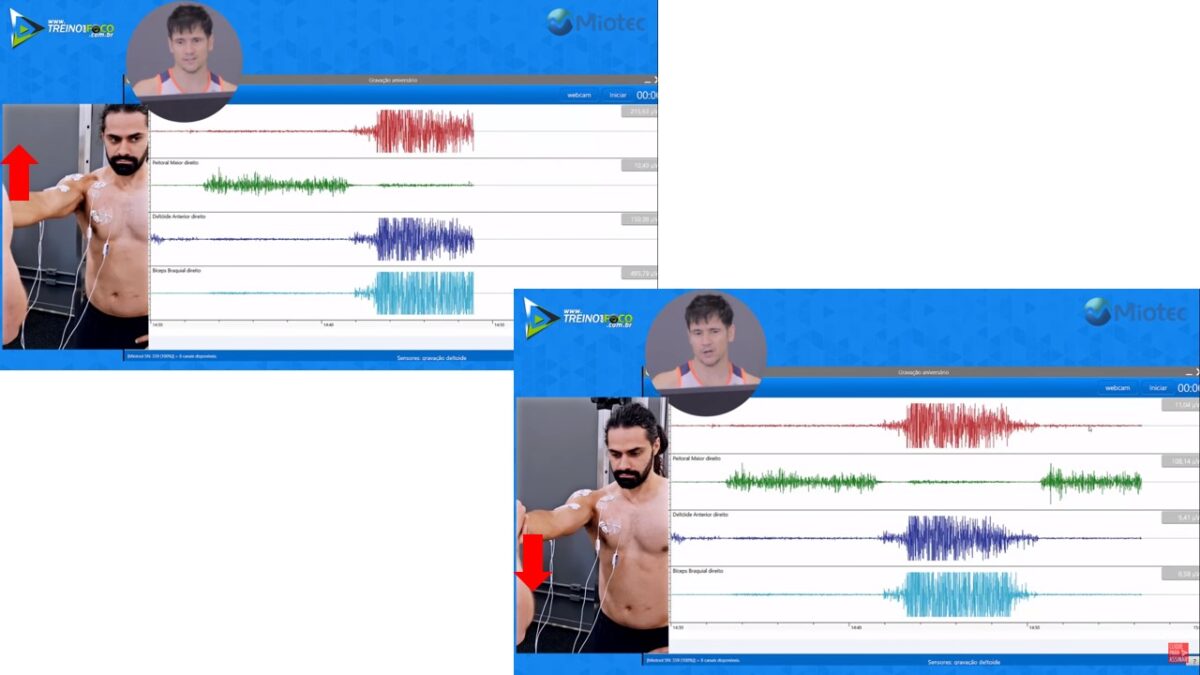 Treino_em_foco_peitoral_inferior_esternocostal