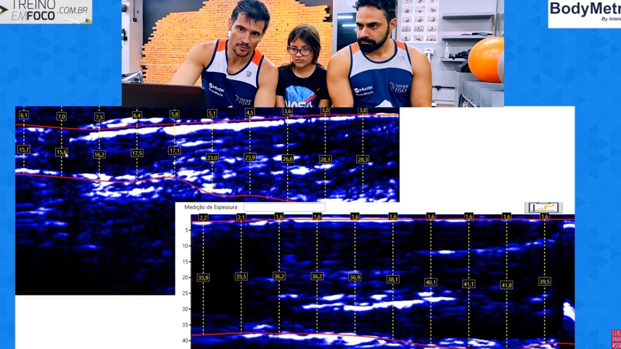 Densidade_muscular_treinamento_avaliação_ultrassonografia_treino_em_foco