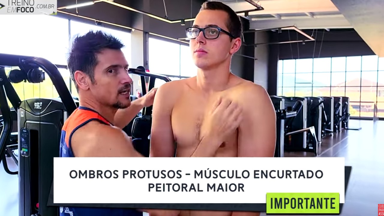 Ombros_protusos_desvio_postural_treino_em_foco