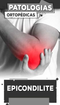 14 - Epicondilite