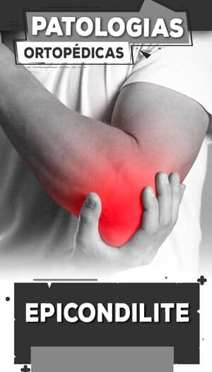 14 - Epicondilite
