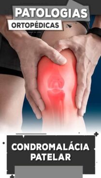 7 - Condromalácia Patelar