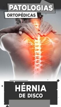 9-Hernia-de-Disco